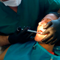 Implantes dentales para renovar tu confianza.